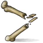 RUST Bone Fragments