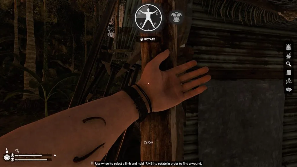 Arm Extended Out with Leeches